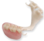 Duracetal tooth-coloured dentures