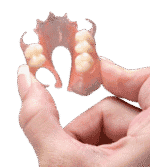 Flexible Dentures
